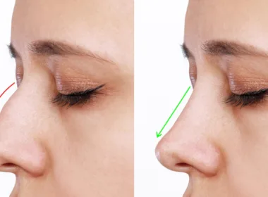 Jak dbać o suchy nos
